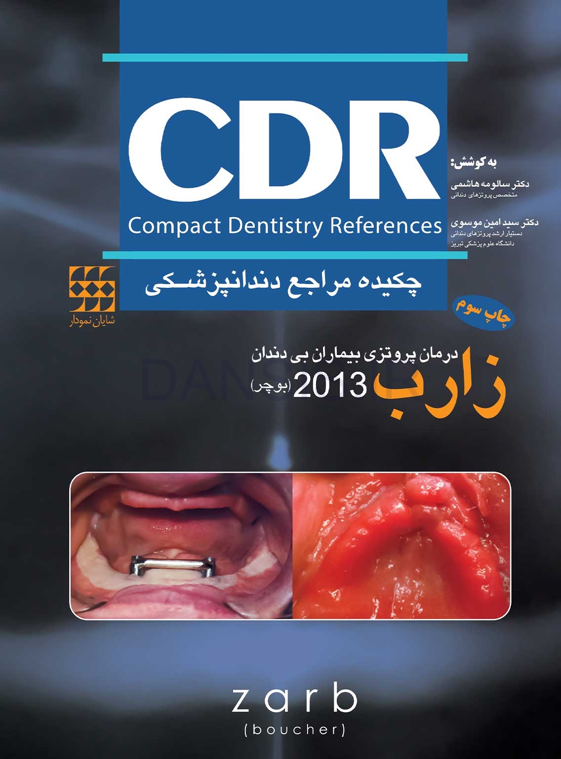 تصویر  CDR درمان پروتزی بیماران بی دندان زارب(بوچر) 2013 (چکیده مراجع دندانپزشکی)