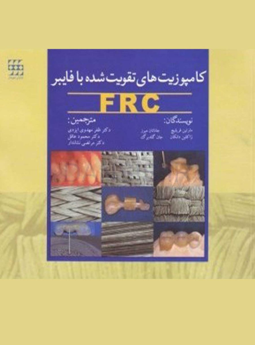 تصویر  کامپوزیت های تقویت شده با فایبر FRC