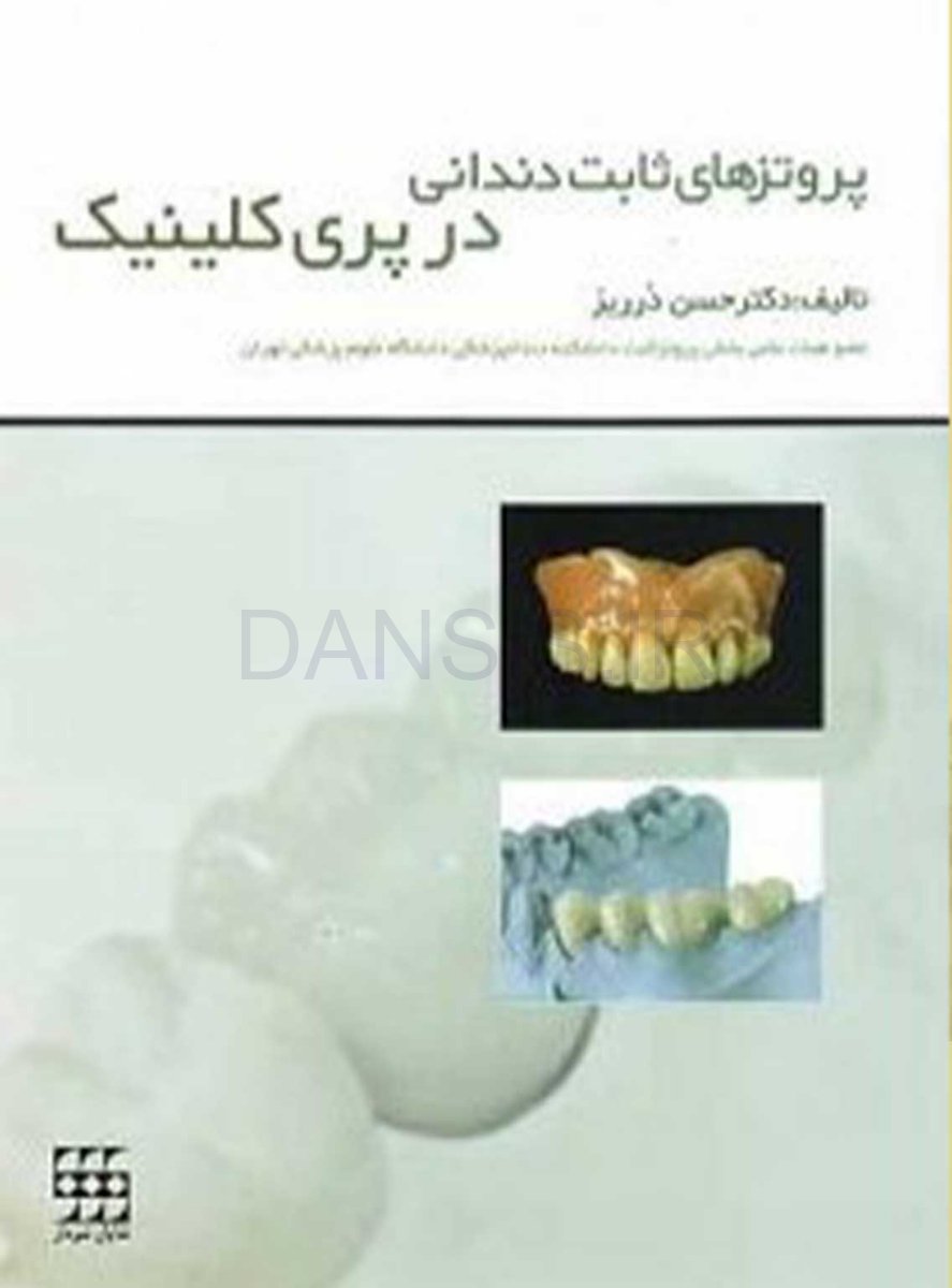 تصویر  پروتزهای ثابت دندانی در پری کلینیک
