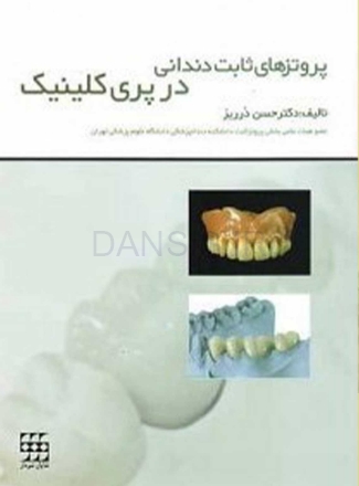 تصویر  پروتزهای ثابت دندانی در پری کلینیک