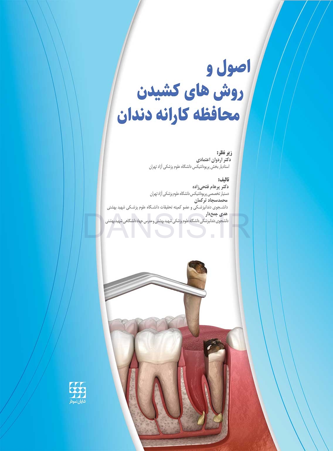 تصویر  اصول و روش های کشیدن محافظه کارانه دندان