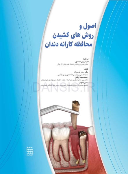 تصویر  اصول و روش های کشیدن محافظه کارانه دندان