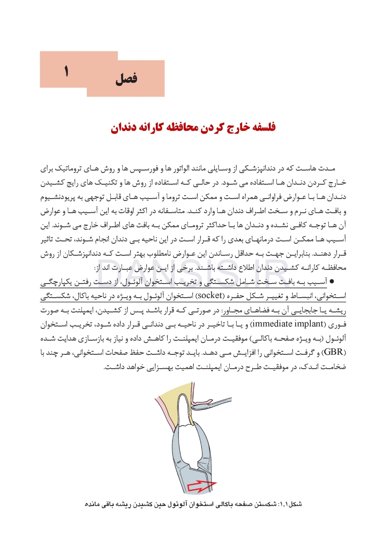 تصویر  اصول و روش های کشیدن محافظه کارانه دندان