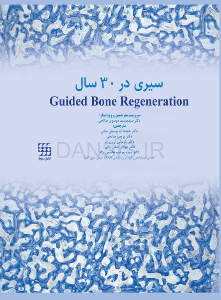 تصویر  Guided Bone Regeneration سیری در 30 سال