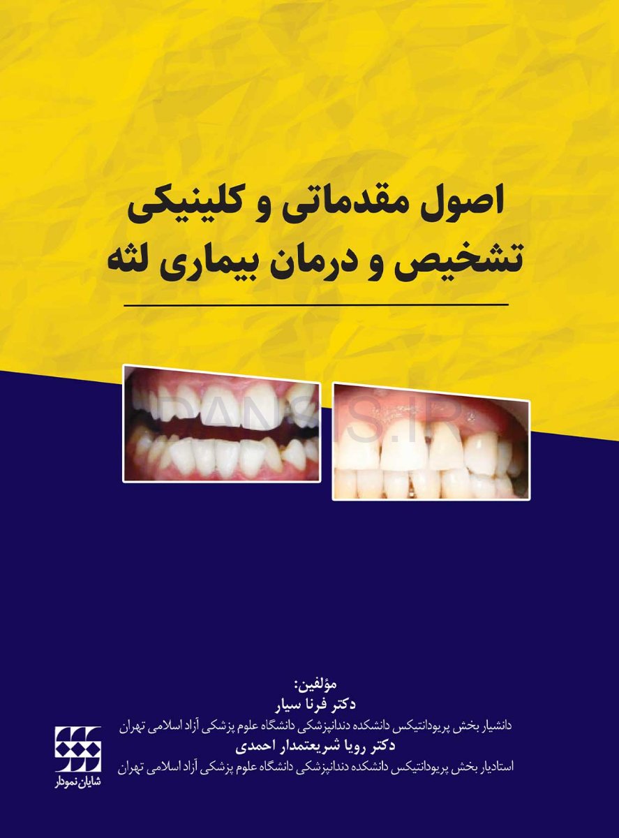 تصویر  اصول مقدماتی و کلینیکی تشخیص و درمان بیماری لثه