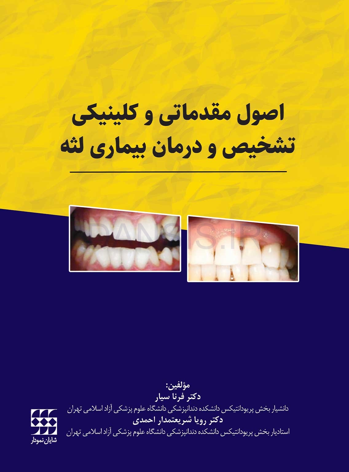 تصویر  اصول مقدماتی و کلینیکی تشخیص و درمان بیماری لثه