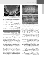 تصویر  پریودنتولوژی بالینی کارانزا 2019 جلد 2 همراه با CD (سیاه و سفید)