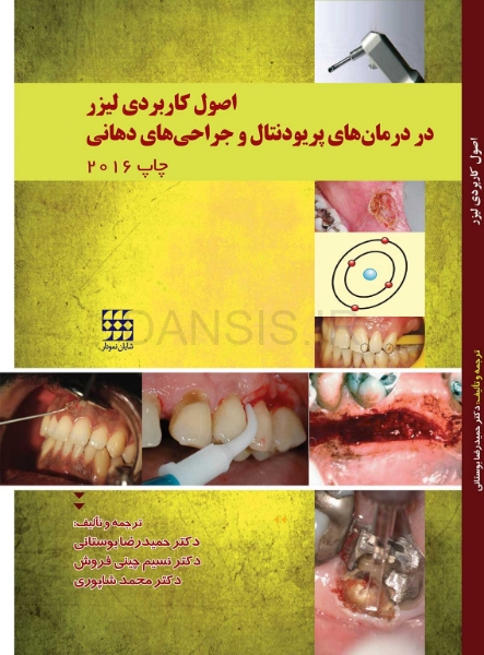تصویر  اصول کاربردی لیزر در درمانهای پریودنتال و جراحی های دهان