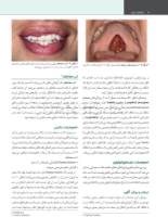 تصویر  پاتولوژی دهان، فک و صورت نویل 2024 جلد یک (رنگی)