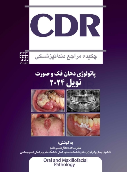 تصویر  CDR پاتولوژی دهان فک و صورت نویل 2024 (چکیده مراجع دندانپزشکی)
