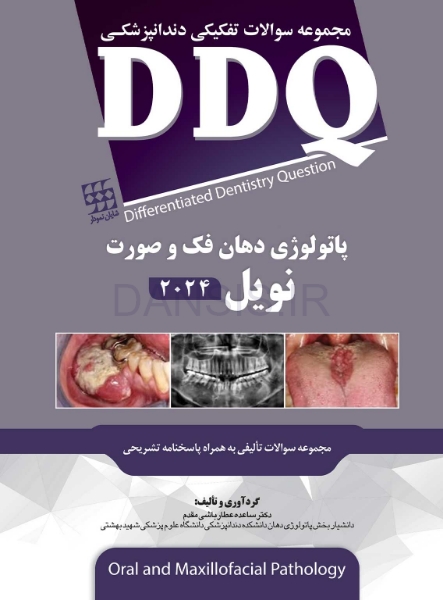 تصویر  DDQ پاتولوژی دهان، فک و صورت نویل 2024 (مجموعه سوالات تفکیکی دندانپزشکی)