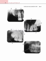 تصویر  اطلس رادیوگرافیک آناتومی و پاتولوژی دندانی