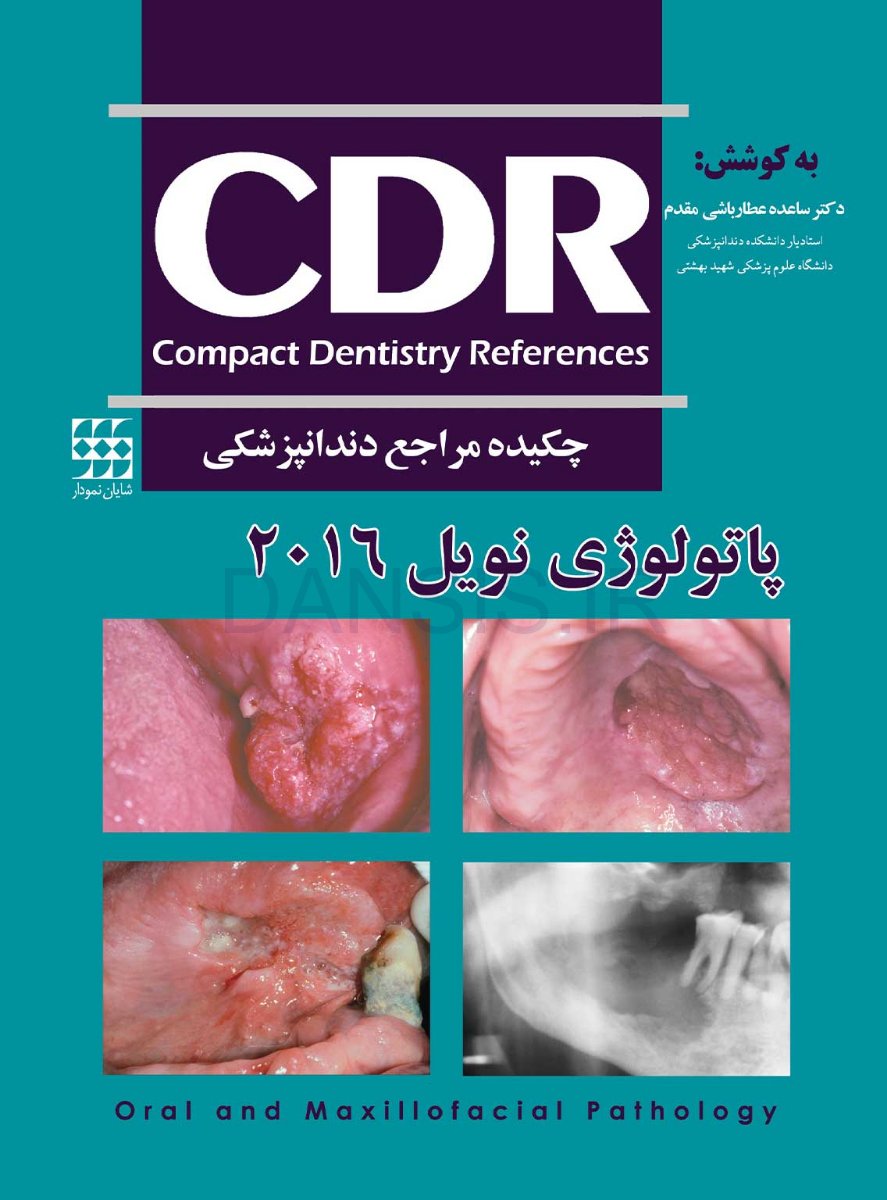 تصویر  CDR پاتولوژی نویل 2016 (چکیده مراجع دندانپزشکی)