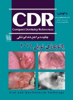 تصویر  CDR پاتولوژی نویل 2016 (چکیده مراجع دندانپزشکی)