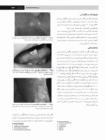 تصویر  پاتولوژی دهان، فک و صورت نویل 2016 جلد 2 (سیاه و سفید)
