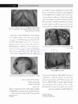 تصویر  پاتولوژی دهان، فک و صورت نویل 2016 جلد 1 (سیاه و سفید)