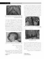 تصویر  پاتولوژی دهان، فک و صورت نویل 2016 جلد 1 (سیاه و سفید)