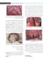 تصویر  پاتولوژی دهان، فک و صورت نویل 2016 رنگی (تک جلدی)