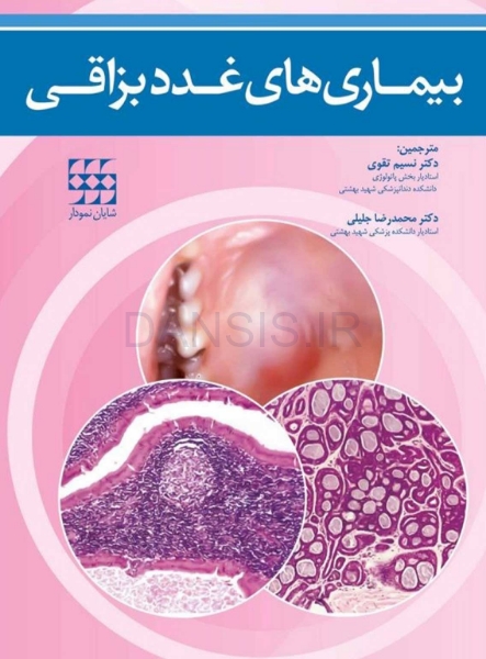 تصویر  بیماریهای غدد بزاقی