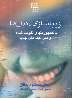 تصویر  زیباسازی دندان ها با کامپوزیت های تقویت شده و سرامیک های جدید