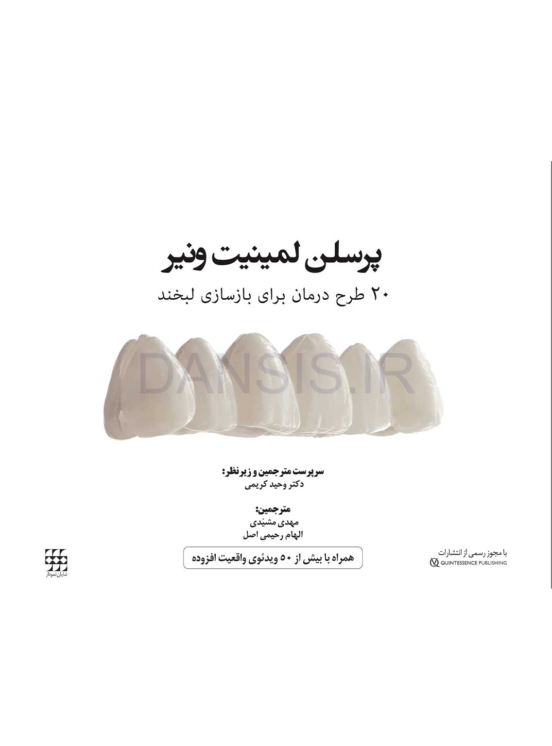 تصویر  پرسلن لمینیت ونیر(20 طرح درمان برای بازسازی لبخند)