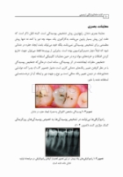 تصویر  لذت دندانپزشکی ترمیمی
