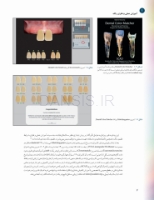 تصویر  رنگ در دندانپزشکی (راهنمای کلینیکی برای زیبایی پیش بینی پذیر) گلاسه رنگی