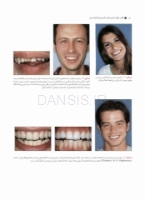 تصویر  اصول کاربردی آموزش گام به گام پرسلن لامینیت ونیر (2 جلدی)