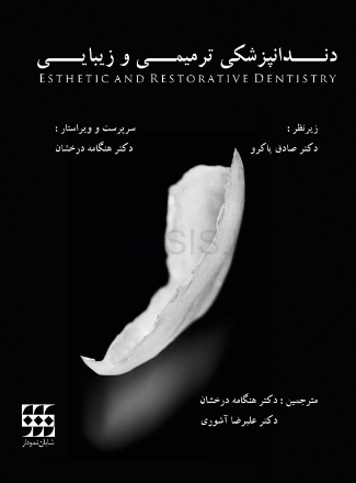 تصویر  دندانپزشکی ترمیمی و زیبایی گلاسه رنگی با قاب