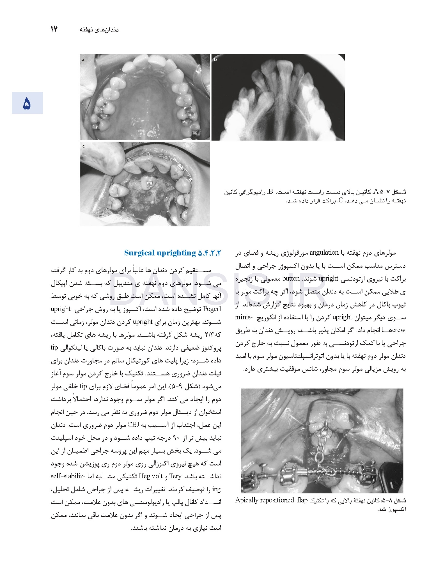 تصویر  اصول جراحی دهان فک و صورت پیترسون 2022 (جلد دوم)