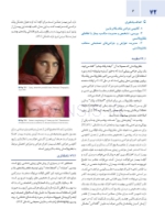 تصویر  اصول جراحی دهان، فک و صورت پیترسون 2022 زیبایی – جلد چهارم