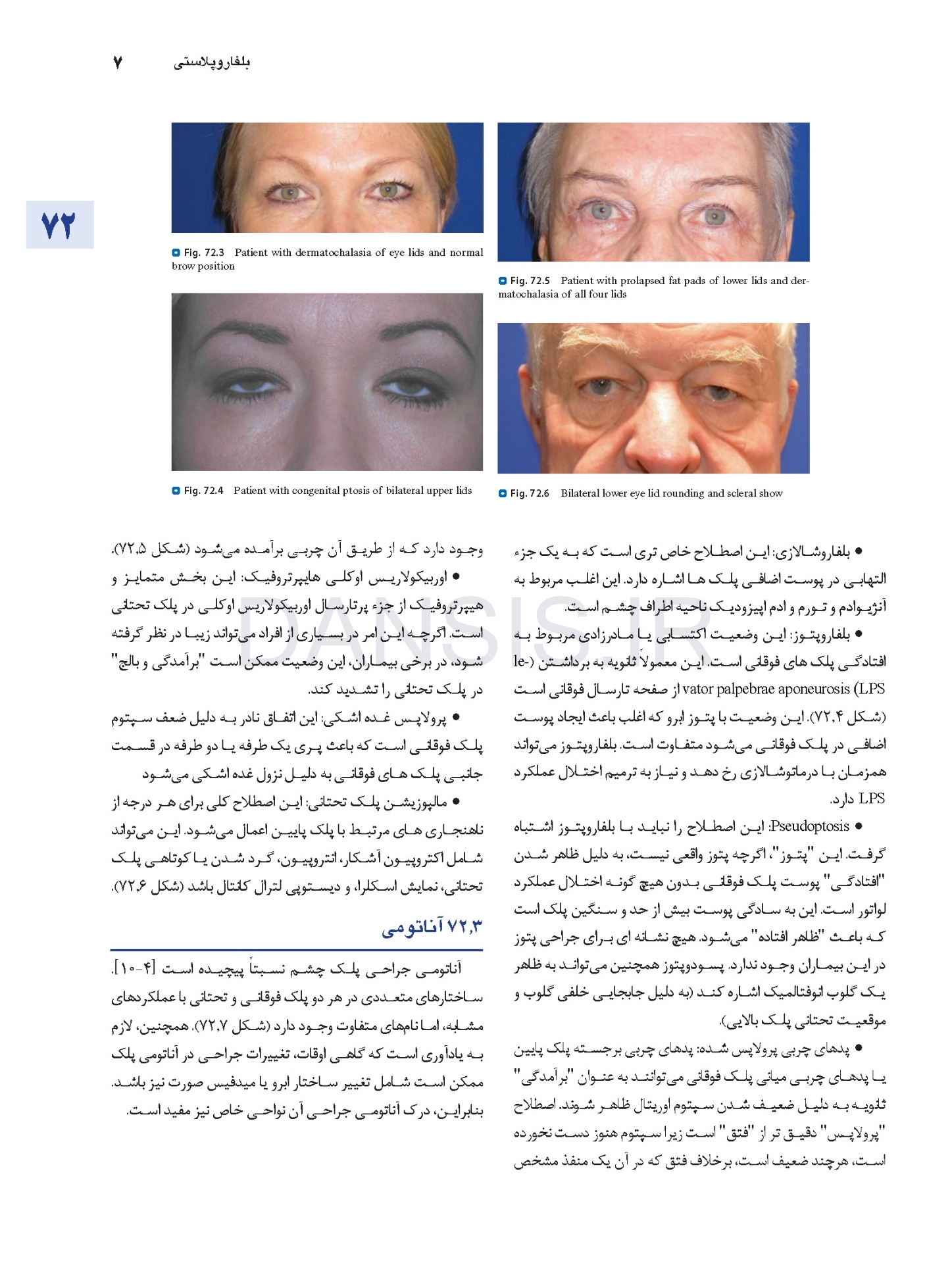 تصویر  اصول جراحی دهان، فک و صورت پیترسون 2022 زیبایی – جلد چهارم
