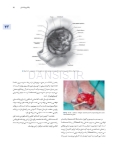 تصویر  اصول جراحی دهان، فک و صورت پیترسون 2022 زیبایی – جلد چهارم