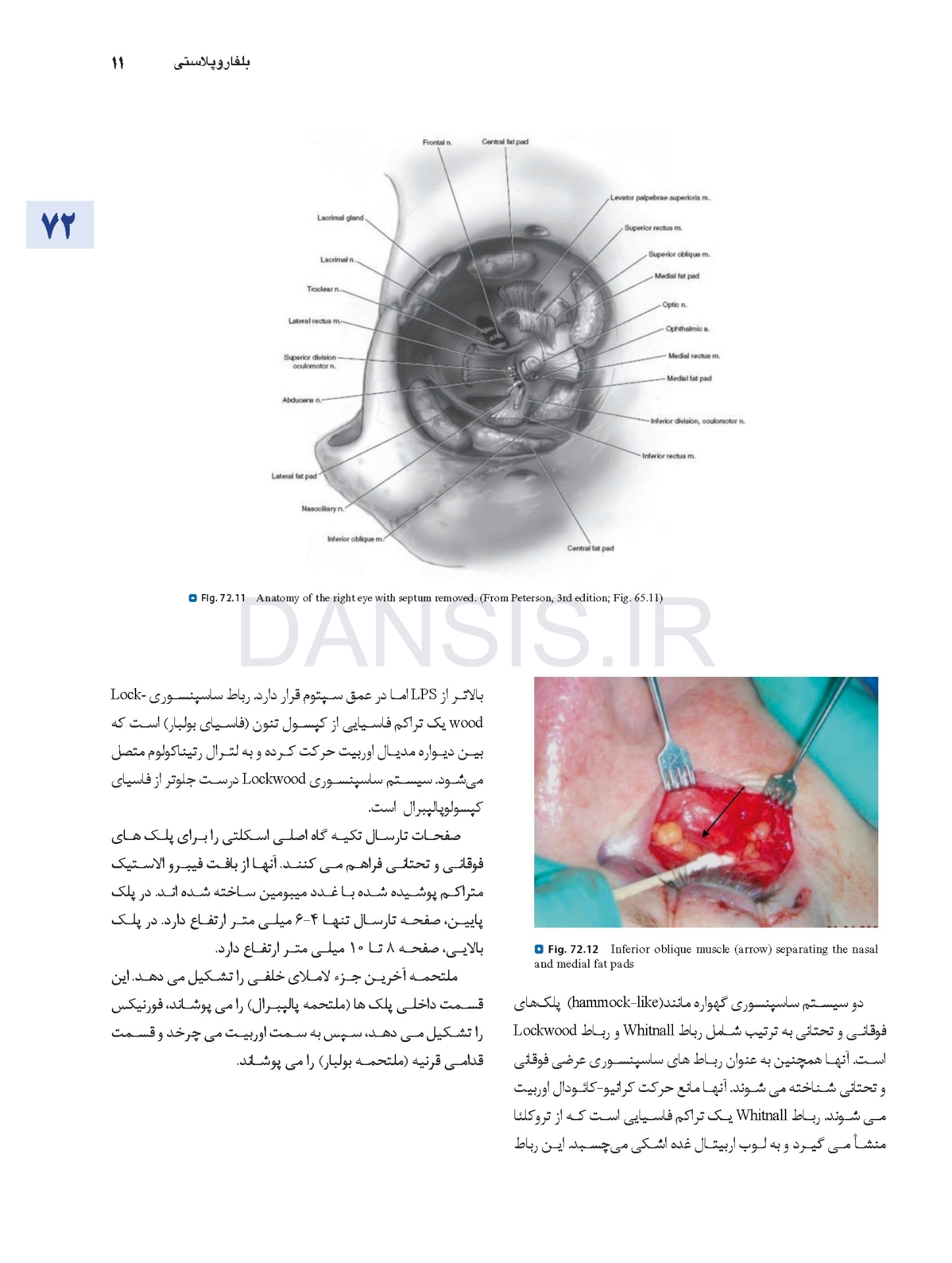 تصویر  اصول جراحی دهان، فک و صورت پیترسون 2022 زیبایی – جلد چهارم