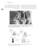 تصویر  اصول جراحی دهان، فک و صورت پیترسون 2022 ارتوگناتیک – جلد سوم