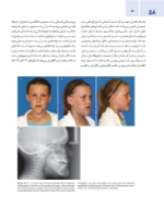 تصویر  اصول جراحی دهان، فک و صورت پیترسون 2022 ارتوگناتیک – جلد سوم