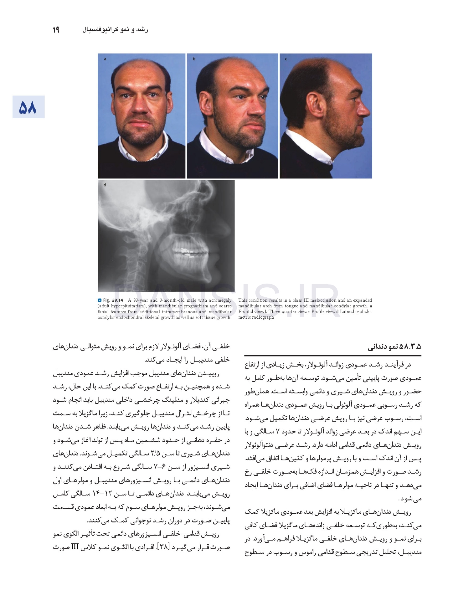 تصویر  اصول جراحی دهان، فک و صورت پیترسون 2022 ارتوگناتیک – جلد سوم