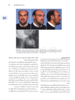 تصویر  اصول جراحی دهان، فک و صورت پیترسون 2022 ارتوگناتیک – جلد سوم