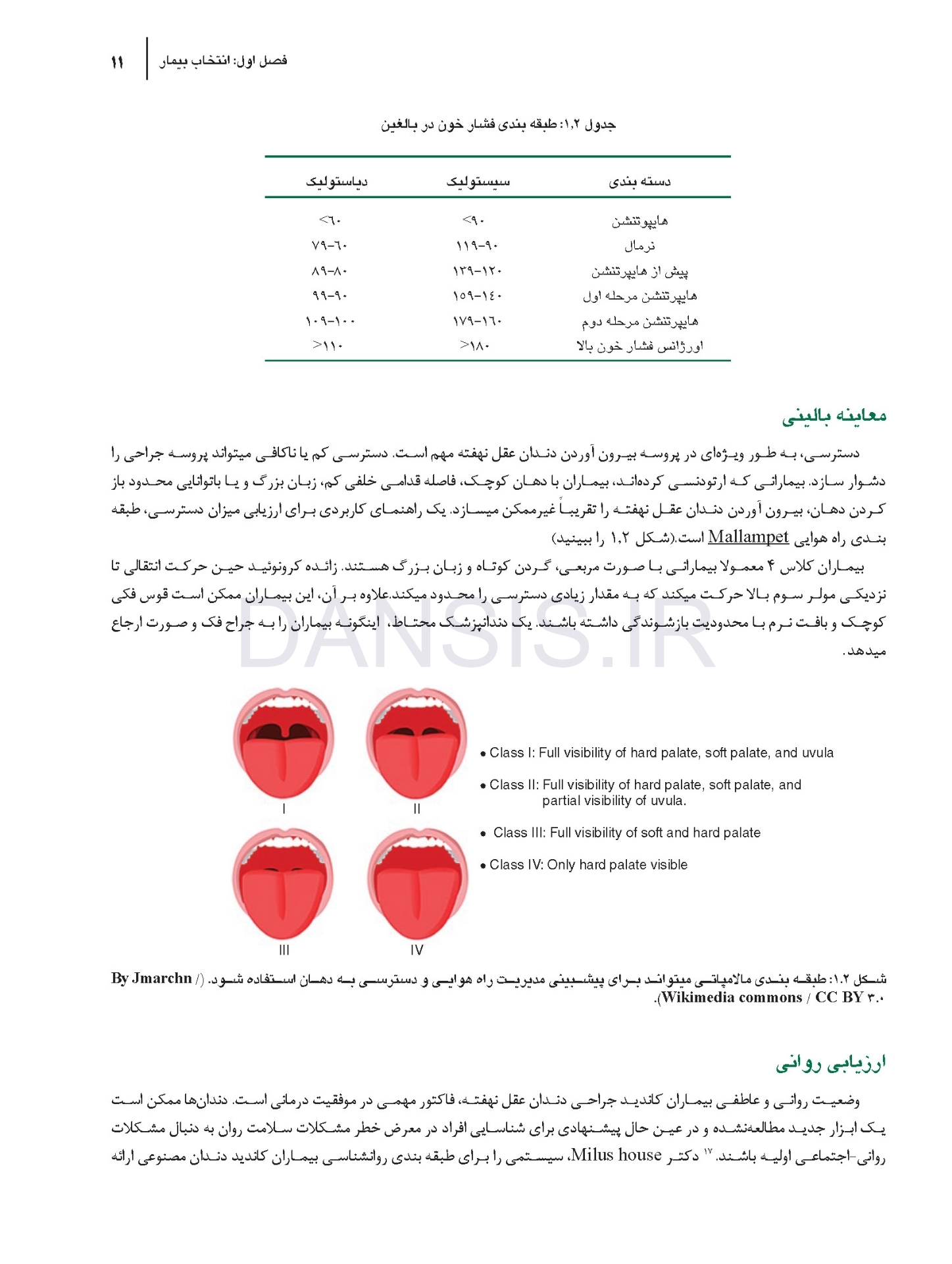 تصویر  جراحی دندان عقل نهفته