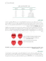 تصویر  جراحی دندان عقل نهفته
