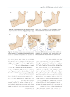تصویر  راهنمای مصور جراحی ارتوگناتیک