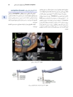 تصویر  اصول جراحی دهان، فک و صورت پیترسون 2022 (جلد اول)