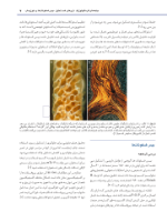 تصویر  استئونکروز فکین ناشی از مصرف داروها