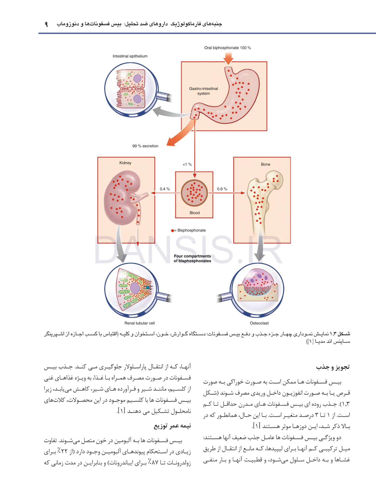 تصویر  استئونکروز فکین ناشی از مصرف داروها