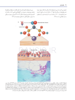 تصویر  استئونکروز فکین ناشی از مصرف داروها