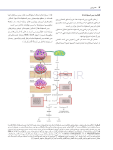 تصویر  استئونکروز فکین ناشی از مصرف داروها