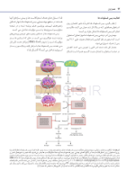 تصویر  استئونکروز فکین ناشی از مصرف داروها