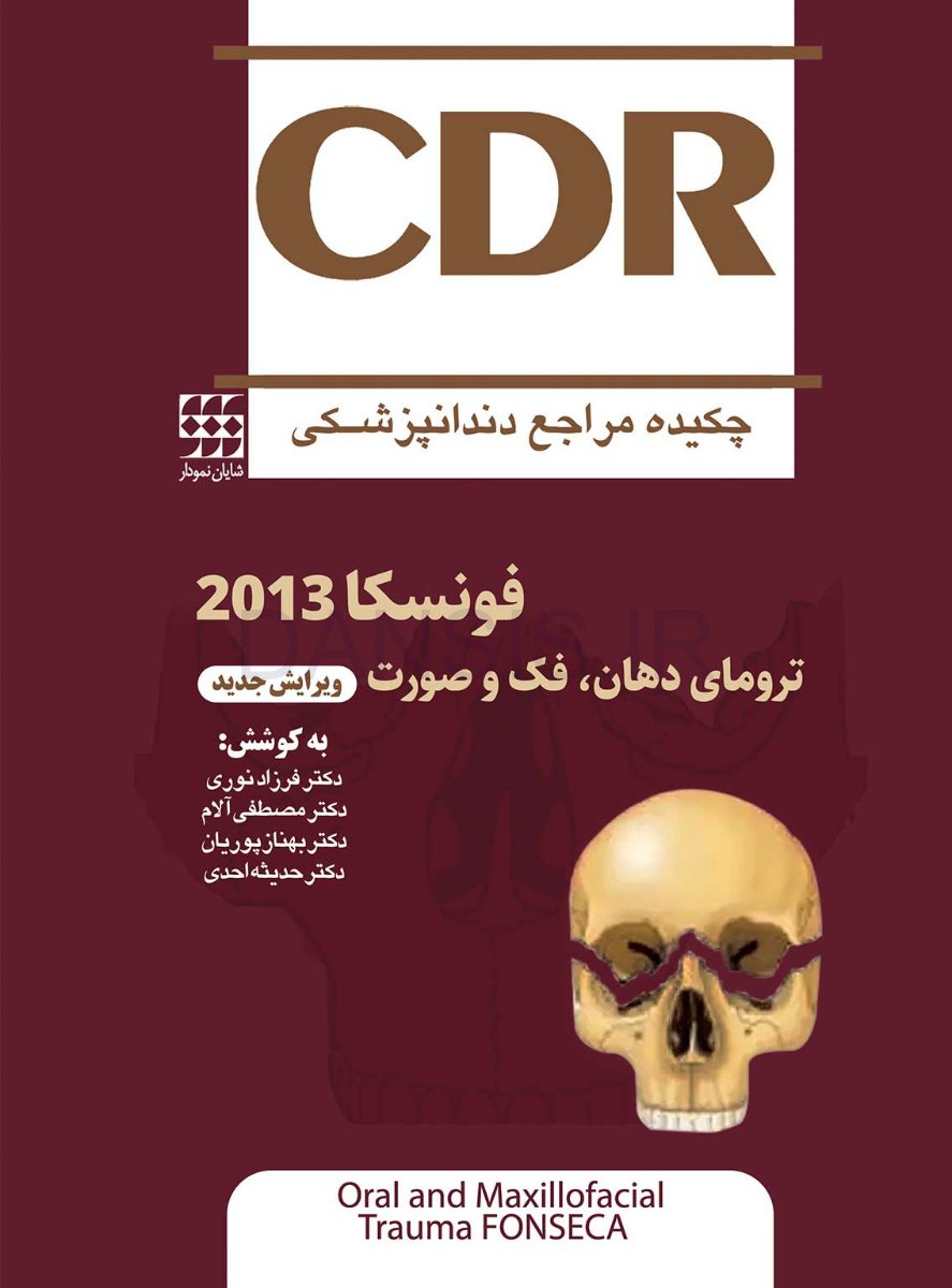 تصویر  CDR ترومای دهان، فک و صورت فونسکا 2013 (چکیده مراجع دندانپزشکی) ویرایش جدید