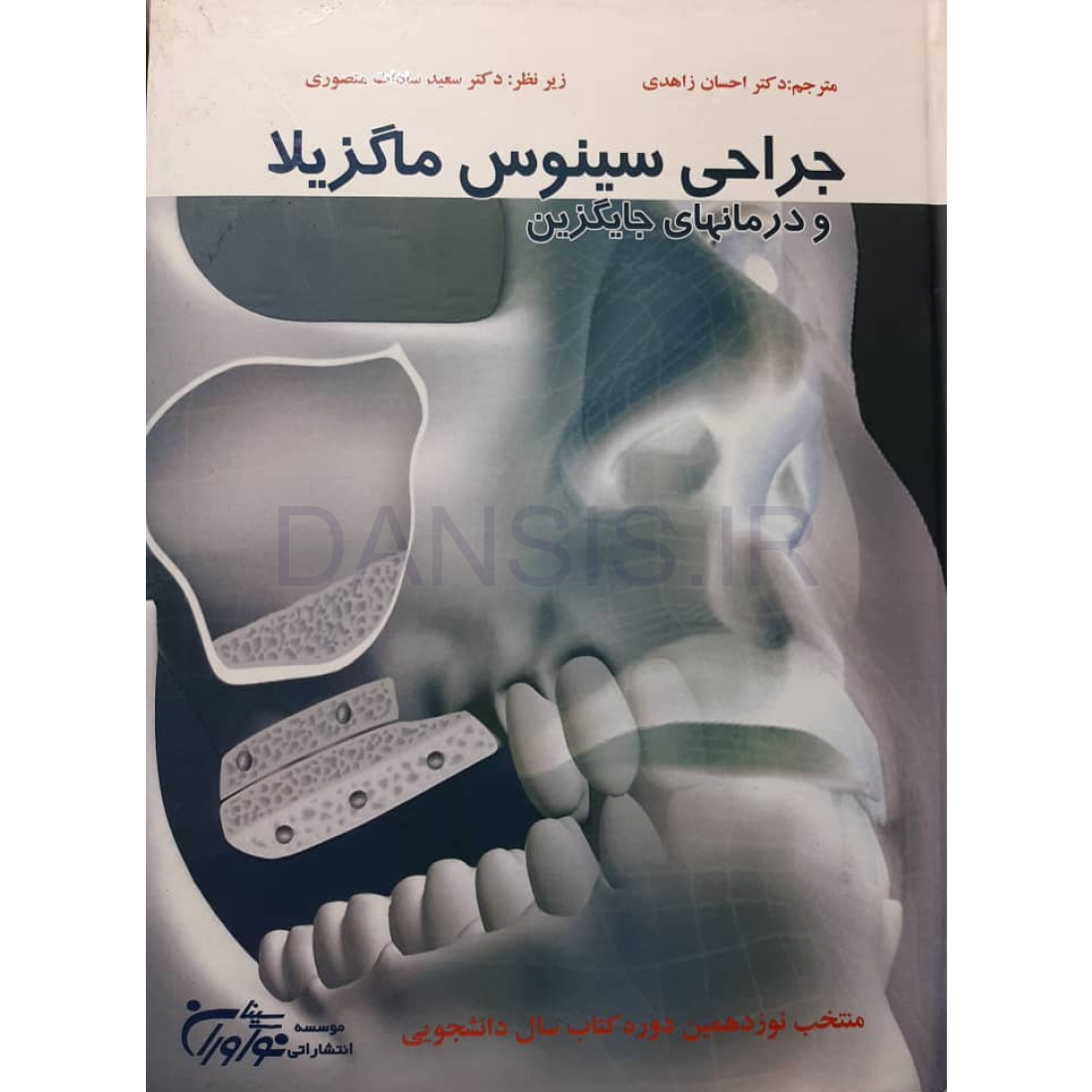 تصویر  جراحی سینوس ماگزیلا و درمان های جایگزین