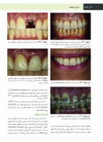 تصویر  جراحی، دهان و فک و صورت فونسکا 2018 جلد پنجم (جراحی ایمپلنت)